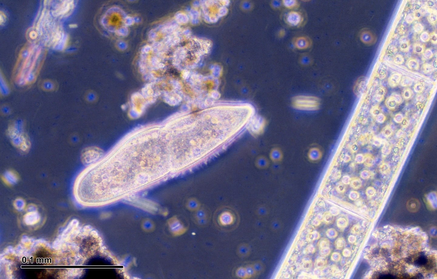 Paramecium caudatum, preparat native dari arsip Josef Reischig.